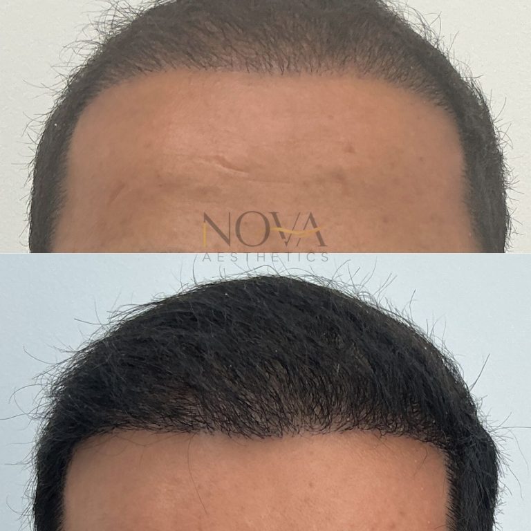 Haarbehandeling Frontpage